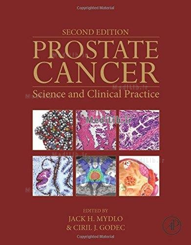 Prostate Cancer