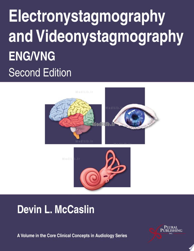 Electronystagmography and Videonystagmography (ENG/VNG), Second Edition