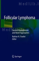 Follicular Lymphoma