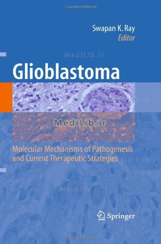Glioblastoma: