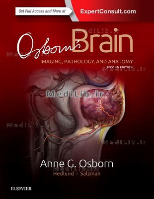 Osborn's Brain (2nd edition Annotated)