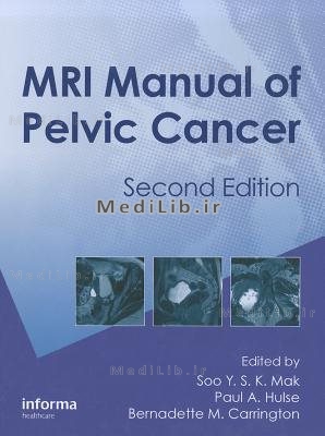 MRI Manual of Pelvic Cancer