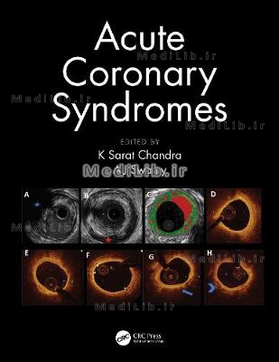 Acute Coronary Syndromes