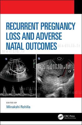 Recurrent Pregnancy Loss and Adverse Natal Outcomes