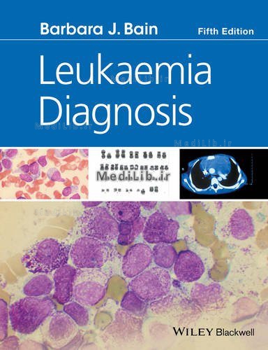Leukaemia Diagnosis