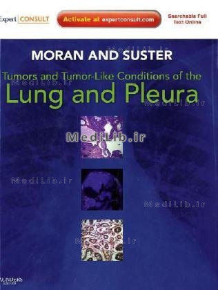 Tumors and Tumor-like Conditions of the Lung and Pleura