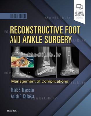 Reconstructive Foot and Ankle Surgery: Management of Complications (3rd edition)
