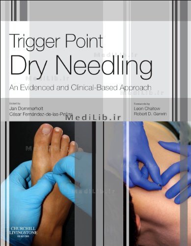 Trigger Point Dry Needling,An Evidence and Clinical-Based Approach,1