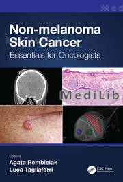 Non-melanoma Skin Cancer 1st Edition
Essentials for Oncologists