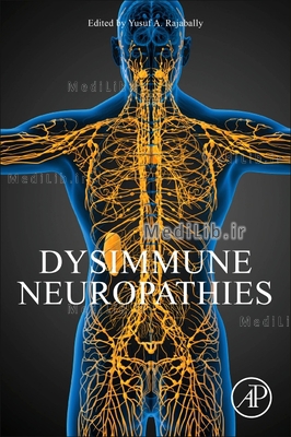 Dysimmune Neuropathies