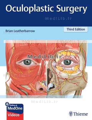 Oculoplastic Surgery (3rd edition)