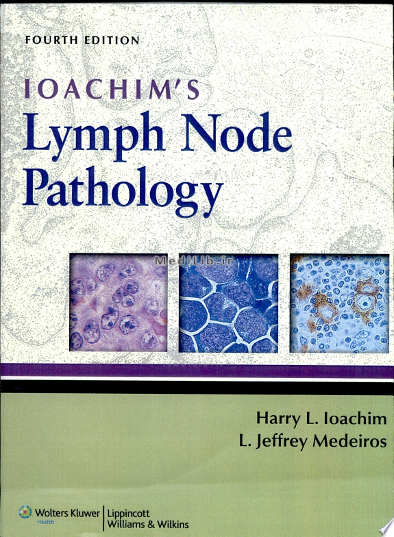 Ioachim's Lymph Node Pathology