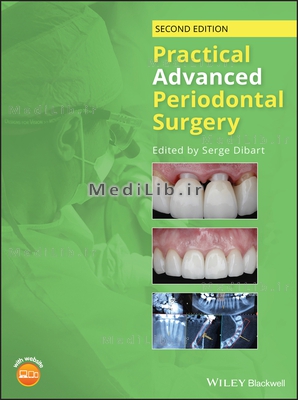 Practical Advanced Periodontal Surgery (2nd Edition)