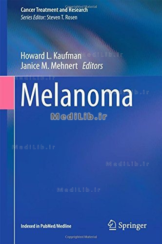 Melanoma