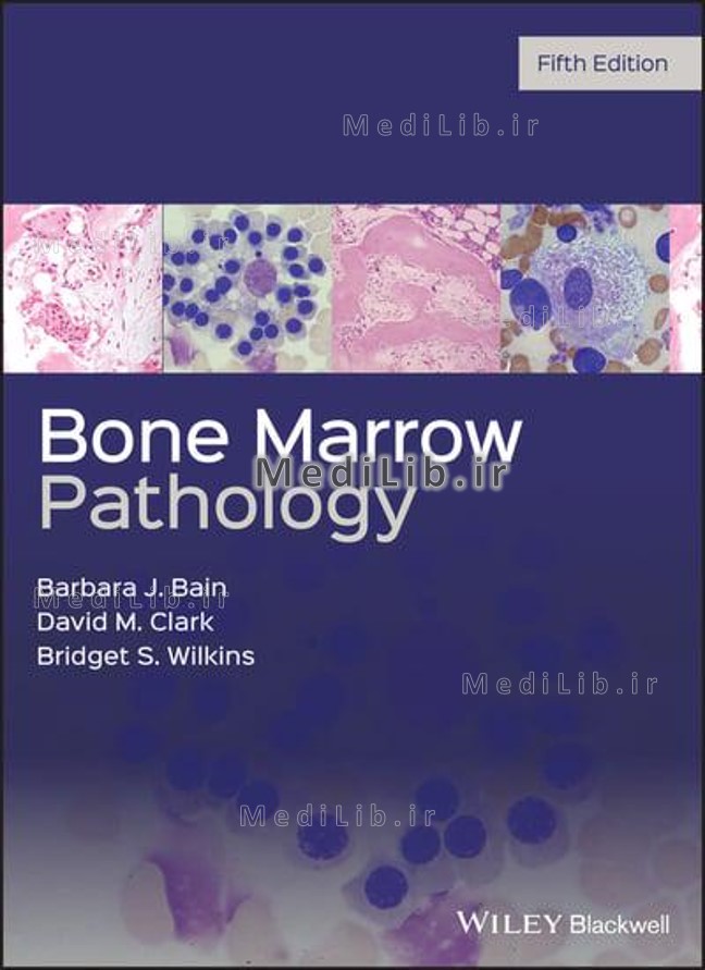 Bone marrow pathology