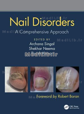 Nail Disorders: A Comprehensive Approach