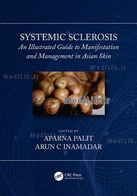 Systemic Sclerosis: An Illustrated Guide to Manifestation and Management in Asian Skin