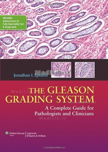 The Gleason Grading System