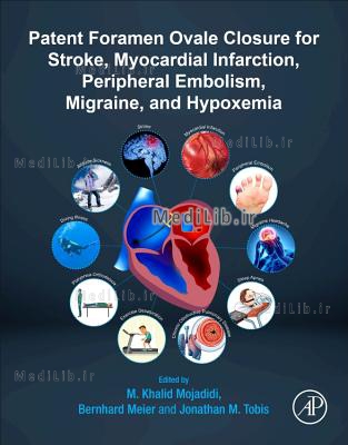 Patent Foramen Ovale Closure for Stroke, Myocardial Infarction, Peripheral Embolism, Migraine, and H
