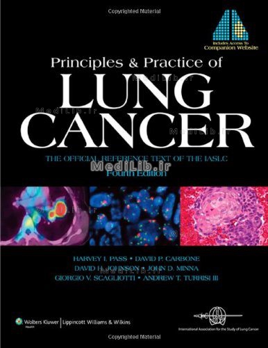 Principles and Practice of Lung Cancer