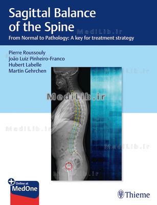 Sagittal Balance of the Spine: From Normal to Pathology: A Key for Treatment Strategy
