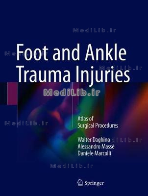 Foot and Ankle Trauma Injuries: Atlas of Surgical Procedures (2018 edition)