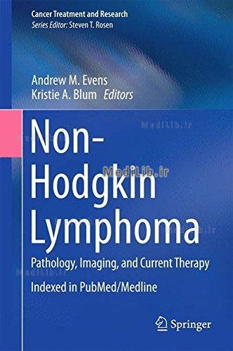 Non-Hodgkin Lymphoma