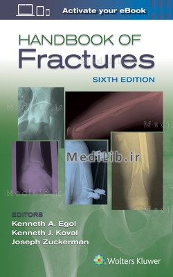 Handbook of Fractures (6th edition)