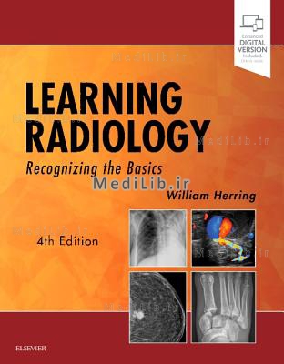Learning Radiology: Recognizing the Basics (4th Revised edition)