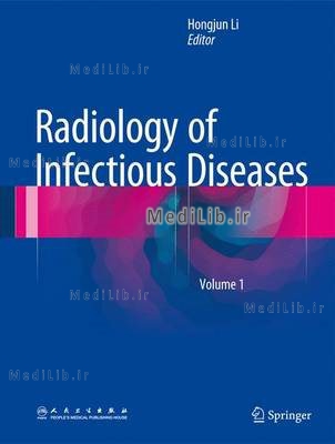 Radiology of Infectious Diseases: