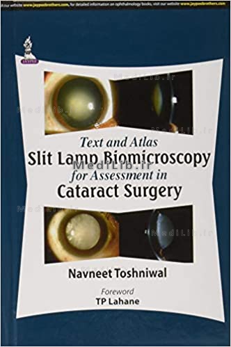Text and Atlas: Slit Lamp Biomicroscopy for Assessment in Cataract Surgery