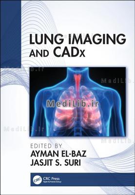 Lung Imaging and Cadx