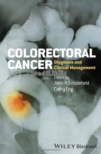 Colorectal Cancer