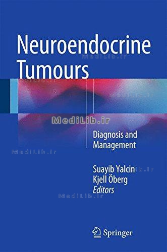 Neuroendocrine Tumours