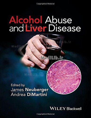 Alcohol Abuse and Liver Disease