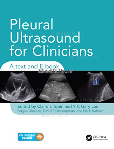 Pleural Ultrasound for Clinicians: A Text and E-book 1st Edition
